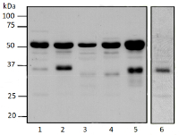 PTOX | Plastid terminal oxidase in the group Antibodies Plant/Algal / Photosynthesis / Electron transfer at Agrisera AB (Antibodies for research) (AS16 3692)